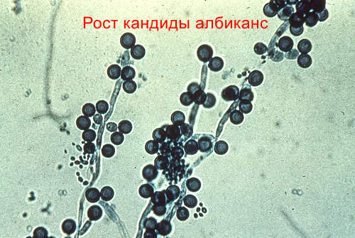 патогенные дрожжевые грибы