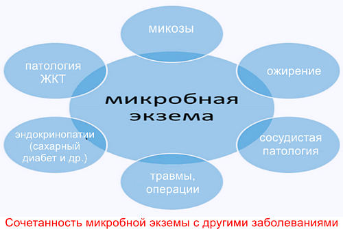 Микробная экзема что это