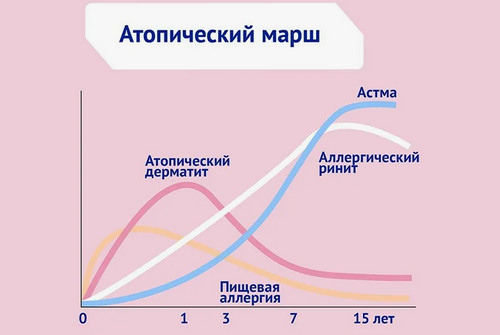 Атопический марш