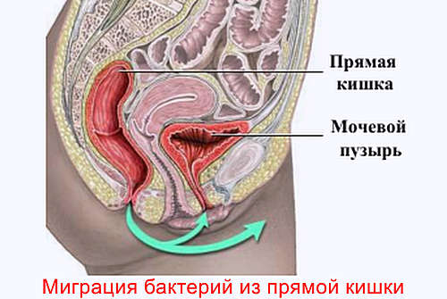 Escherichia coli в мазке у женщины - причины