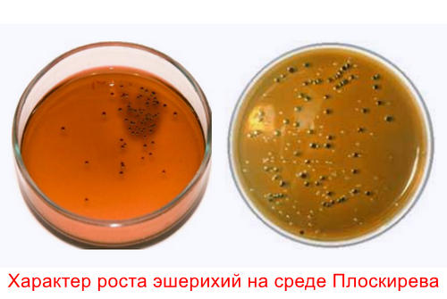 Эшерихия коли в мазке при беременности