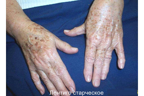 Меланин функции