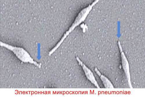 Что такое микоплазма