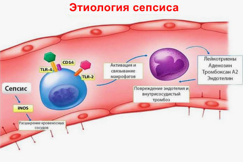 Этиология сепсиса