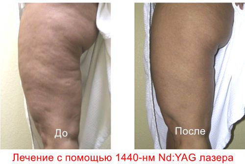 Лазерные и световые методы