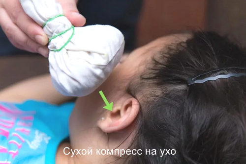 Сухой компресс на ухо