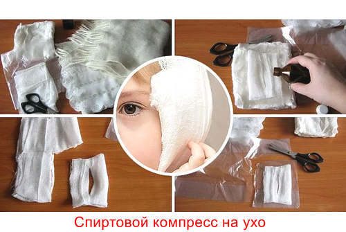 Спиртовой компресс на ухо