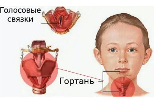 Ларингит патогенез