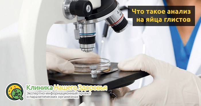 Анализ кала на яйца глист: где и как сдавать анализ на глистов