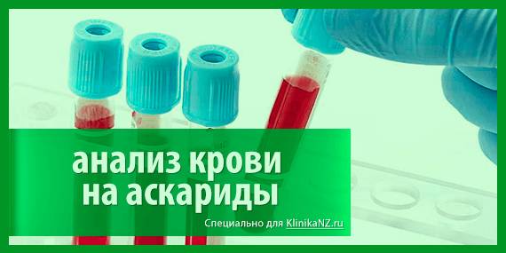 Особенности и методы анализа на антитела к аскаридам