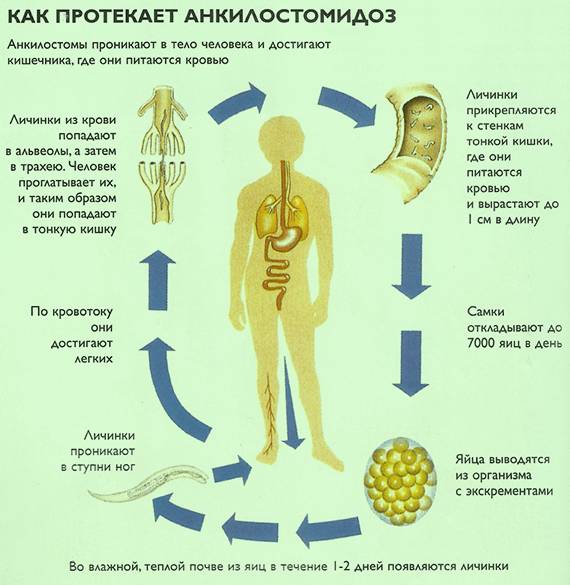 Анкилостомидоз: симптомы и лечение, особенности и развитие