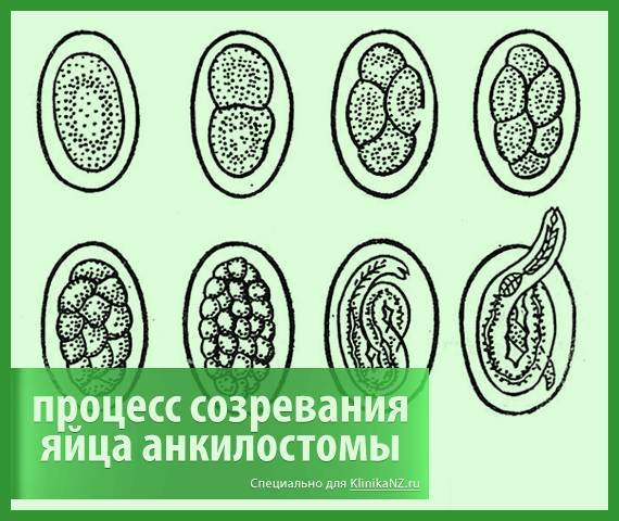 Анкилостомидоз: симптомы и лечение, особенности и развитие