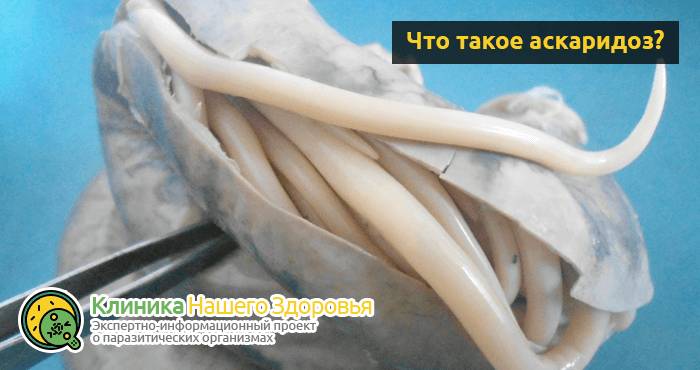 Аскаридоз: описание болезни, симптомы, диагностика и лечение