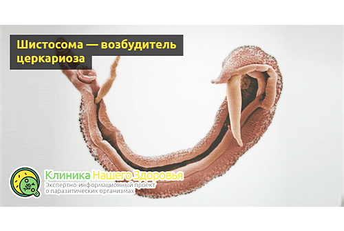 Шистосома — возбудитель церкариоза