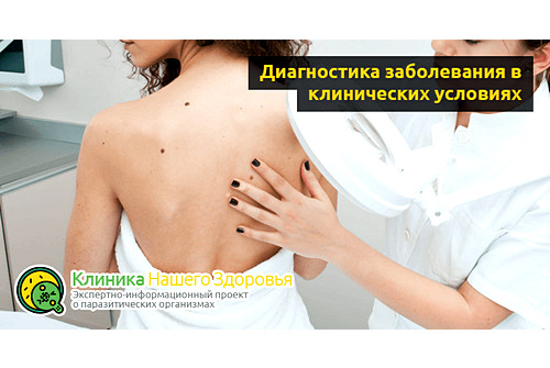 Диагностика заболевания в клинических условиях