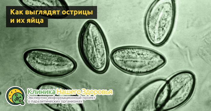Энтеробиоз: симптомы, причины, лечение и профилактика