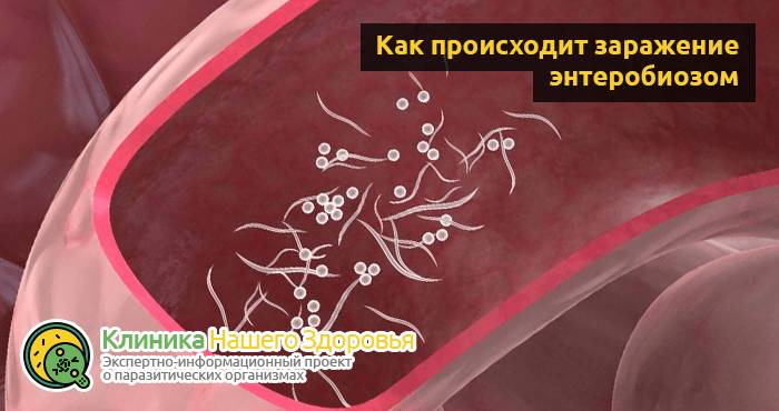 Энтеробиоз: симптомы, причины, лечение и профилактика