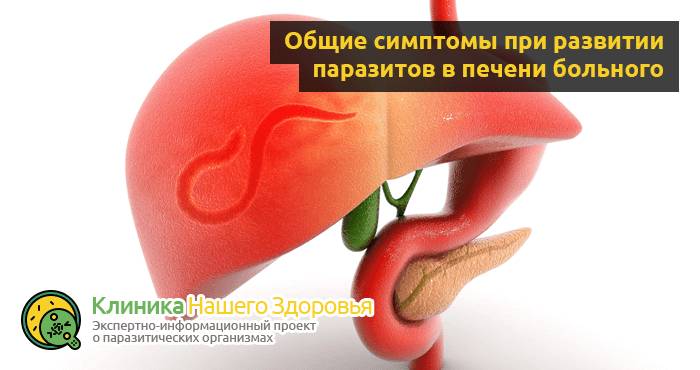 Глисты в печени: симптомы, виды и лечение печеночных паразитов