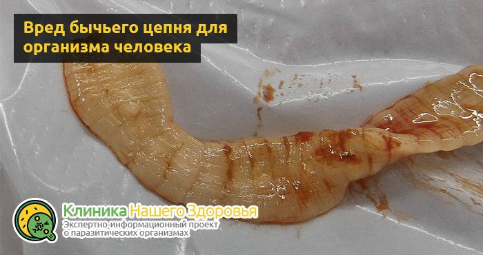 Бычий цепень: как можно заразиться опасным гельминтом