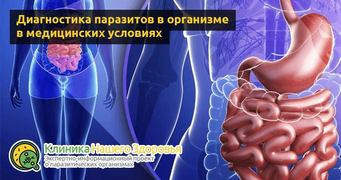 Паразиты в кишечнике человека: симптомы, признаки и лечение