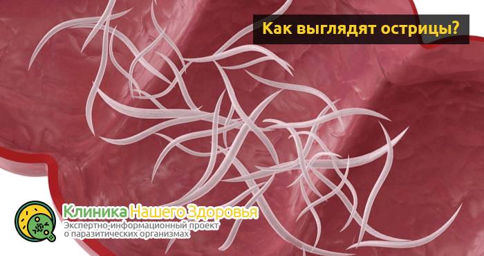 Как избавиться и вывести остриц: лечение в домашних условиях