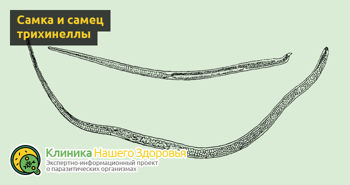 Маленькие белые глисты у человека: виды и особенности