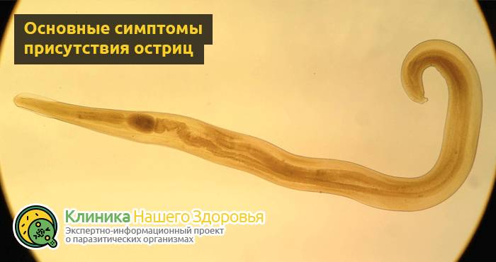 Как избавиться от остриц: лечение в домашних условиях