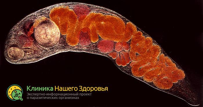 Описторхоз: история, распространение, симптомы и лечение