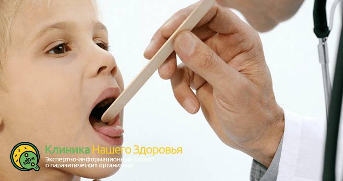 Симптомы и лечение описторхоза у детей: эффективные методы и народная медицина