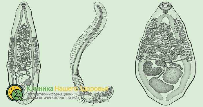 Описторхоз: история, распространение, симптомы и лечение
