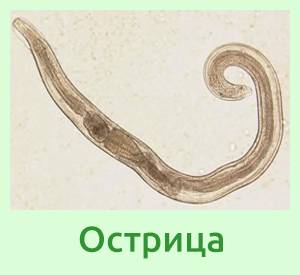 Глисты у людей - виды