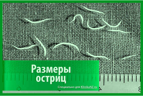 Общая характеристика остриц