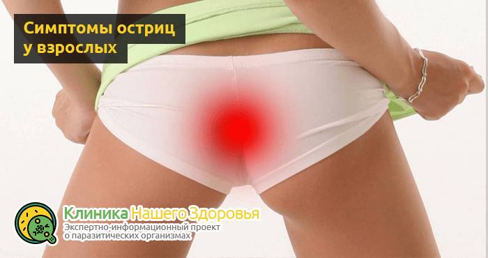 Острицы у взрослых: симптомы и лечение