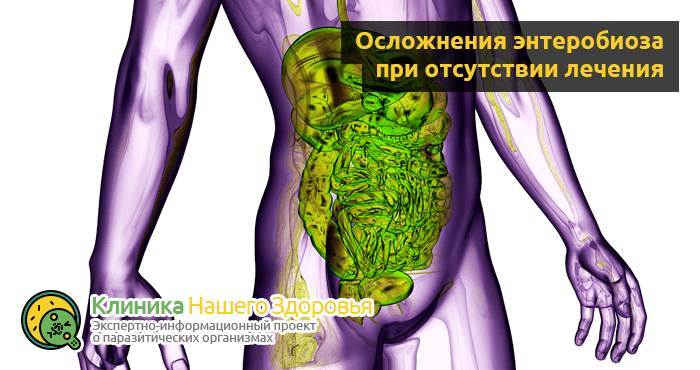 Острицы у взрослых: симптомы и лечение