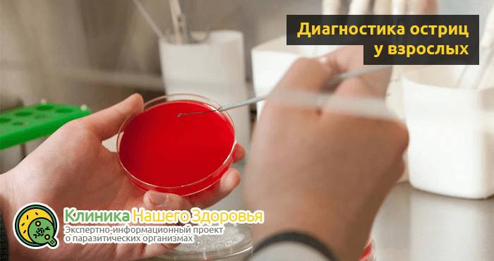 Острицы у взрослых: симптомы и лечение