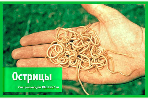 Симптомы присутствия остриц
