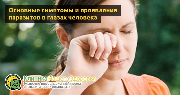 Глисты в глазах: симптомы и лечение паразитов в органах зрения