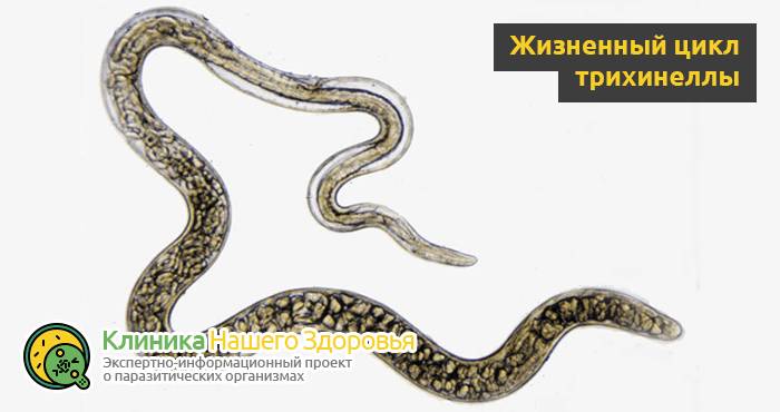 Паразиты в мышцах человека: симптомы, диагностика и лечение