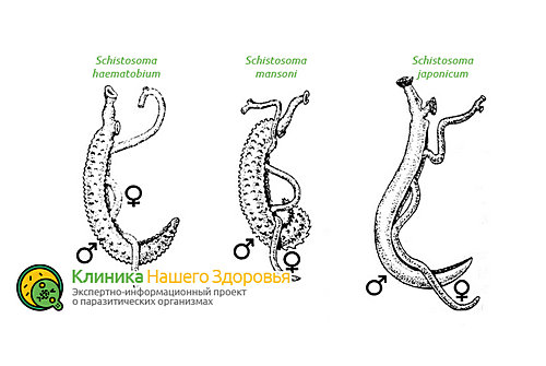 Разновидности шистосом