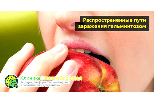 пути заражения гельминтозом
