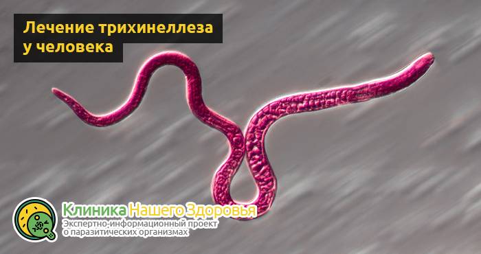 Трихинеллез: причины, симптомы, профилактика и лечение болезни