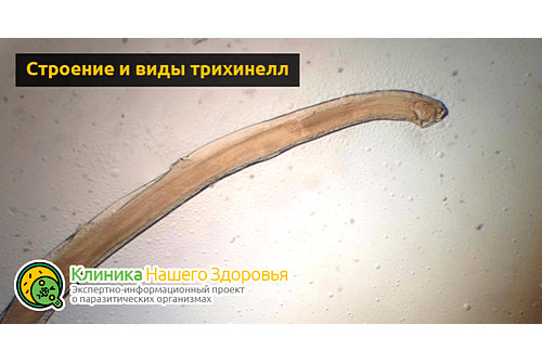 Строение и виды трихинелл