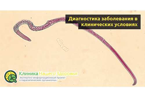 Диагностика заболевания