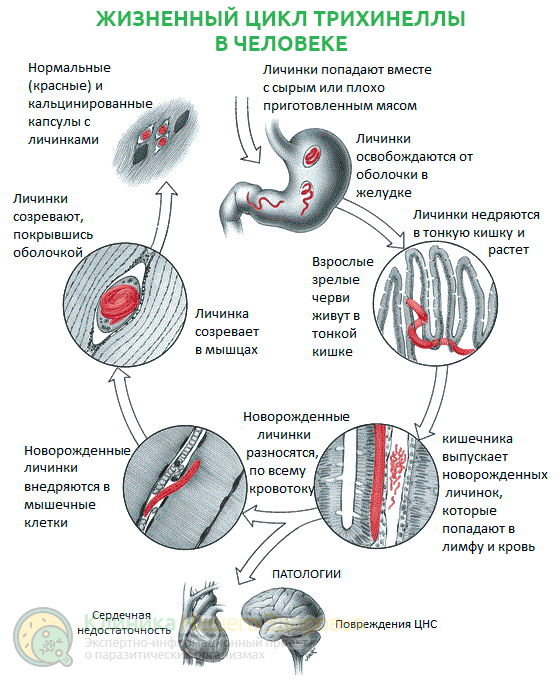 Трихинелла: жизненный цикл, симптомы, диагностика и лечение