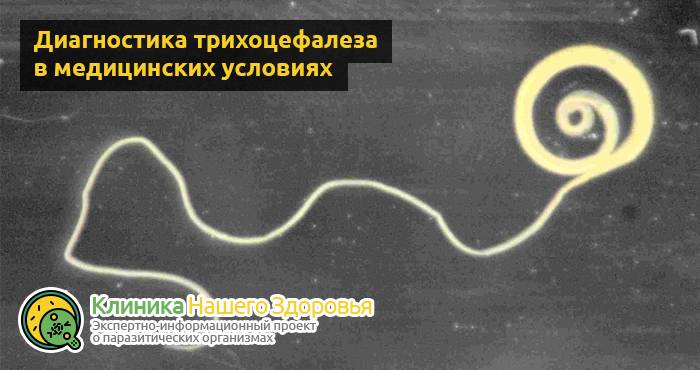 Трихоцефалез человека: симптомы, причины, диагностика и лечение