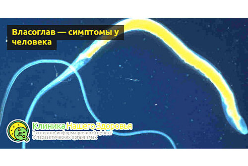 Что такое власоглав