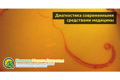 Власоглав симптомы заражения человека