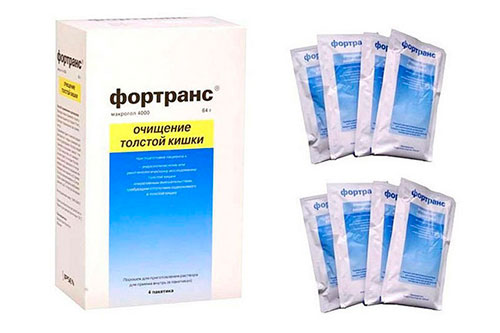 Фортранс