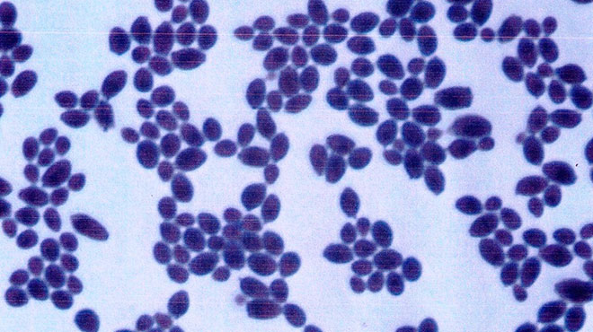 Что такое дрожжи в мазке?