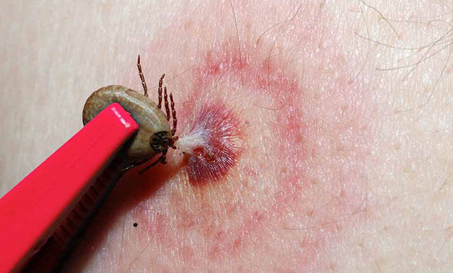 Источники заражения